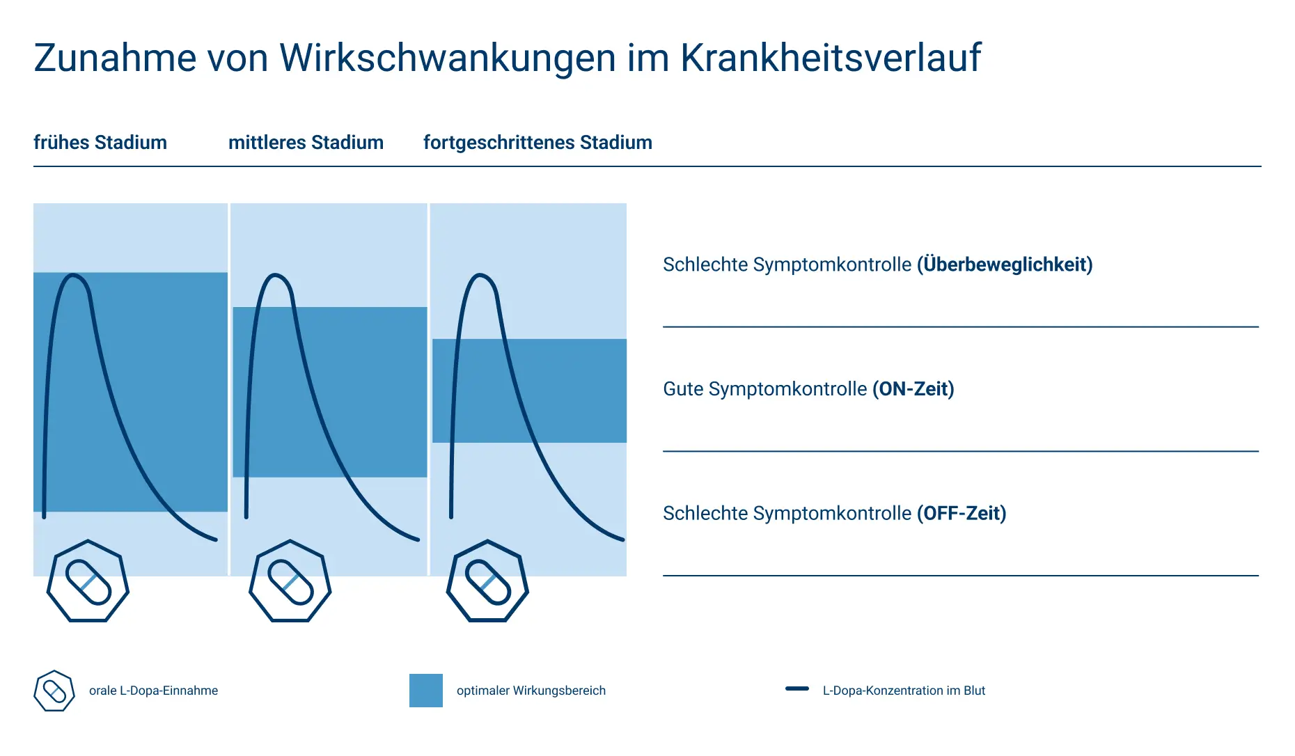 Zunahme von Wirkschwankungen im Verlauf der Parkinson-Erkrankung: 3 Diagramme zeigen, wie die L-Dopa-Konzentration im Blut in verschiedenen Krankheitsstadien schwankt.